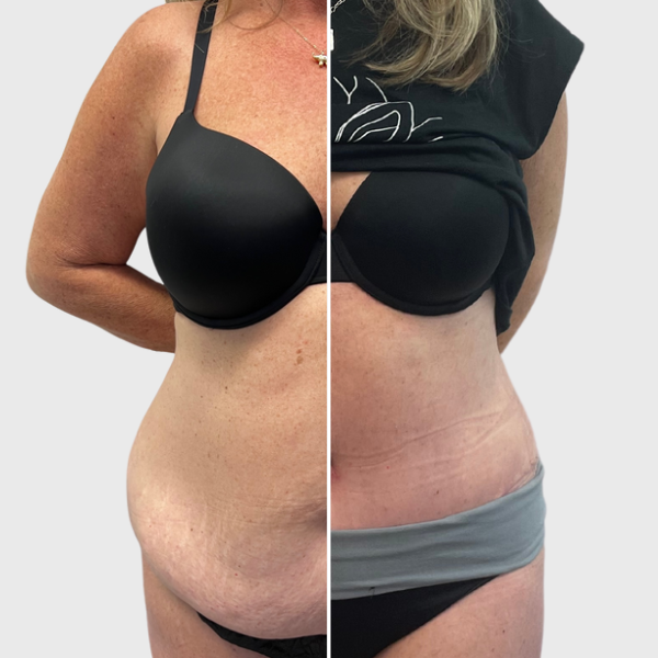 1.19.23 mok tummy-preview