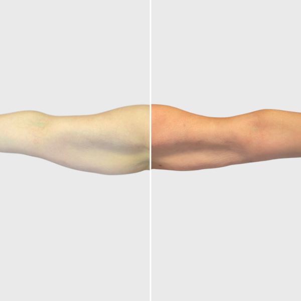 11.15.22 mok arms – preview