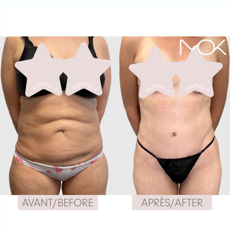 drmokplasticsurgery_377313802_545850287681998_5023894887215442872_n